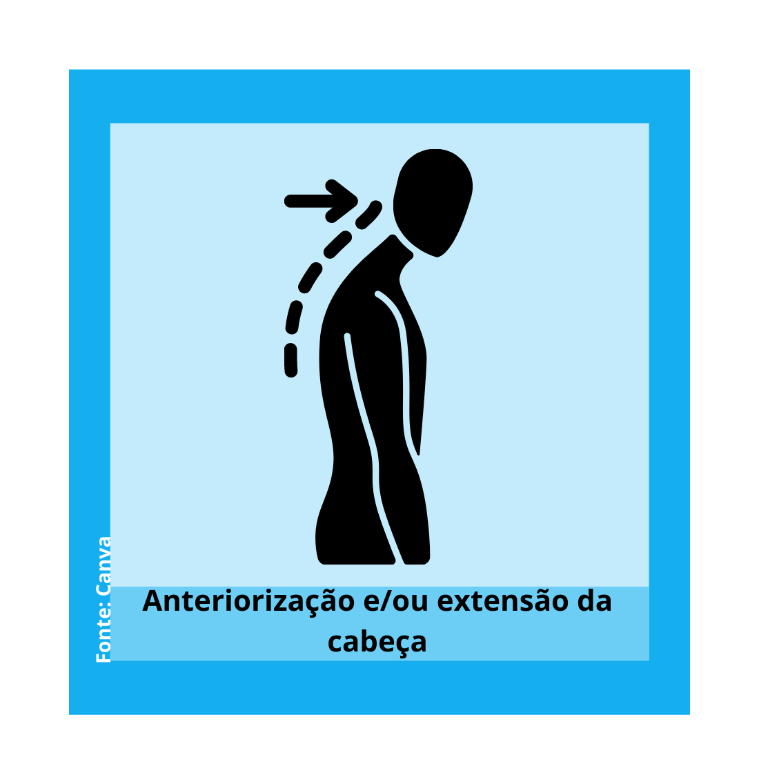imagem anteriorizacao